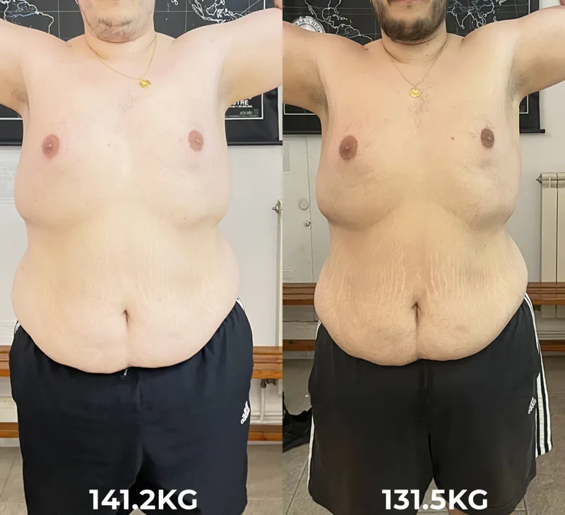 David, antes y después, 15 semanas