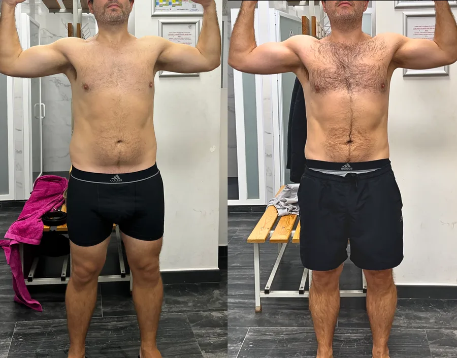Fede, antes y después
