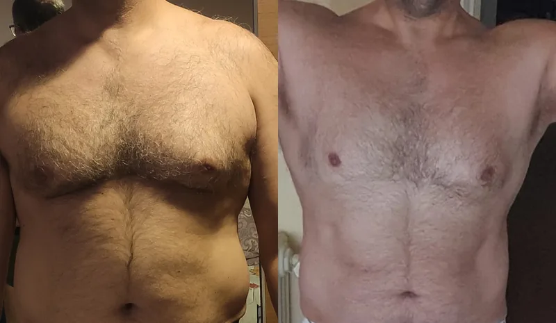 Pepe, antes y después